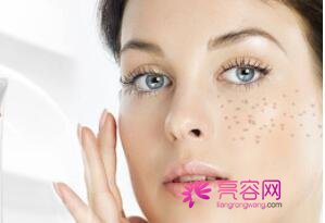 激光祛斑的危害与果你知道哪些?术后有什么注意事项吗?