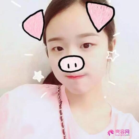 黔东南州人民医院眼科水平怎么样?眼科医生介绍+双眼皮案例分享