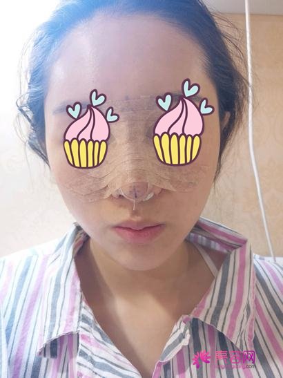 徐学东做鼻子怎么样?快来看详细介绍吧