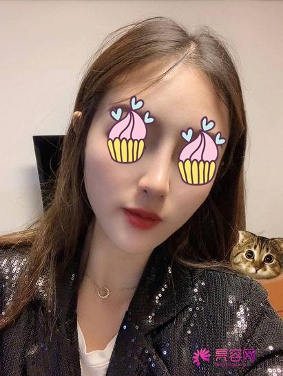 徐学东做鼻子怎么样?快来看详细介绍吧