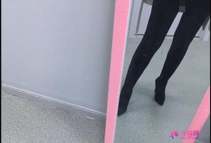 葫芦岛伊丽家张寒做大腿吸脂技术怎么样？医生实力分析+大腿吸脂案例