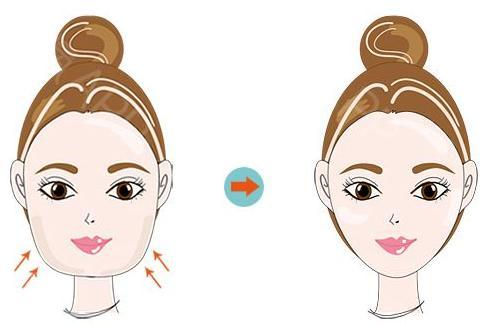 面部吸脂有危险吗 成都艾米丽医院潘红伟 瘦脸就是这么简单