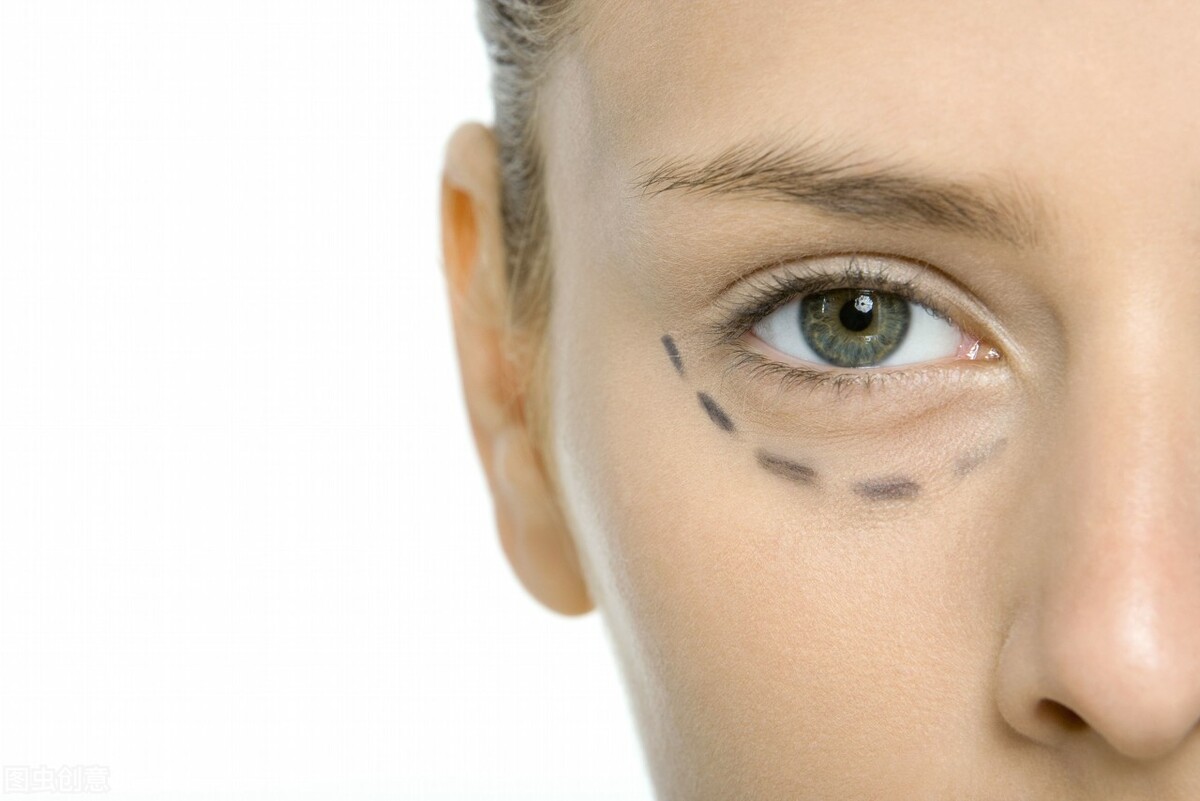 双眼皮术后恢复5个阶段,该怎么护理?