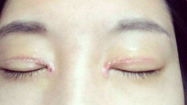 <strong>怎么样双眼皮才算失败你清楚吗?</strong>