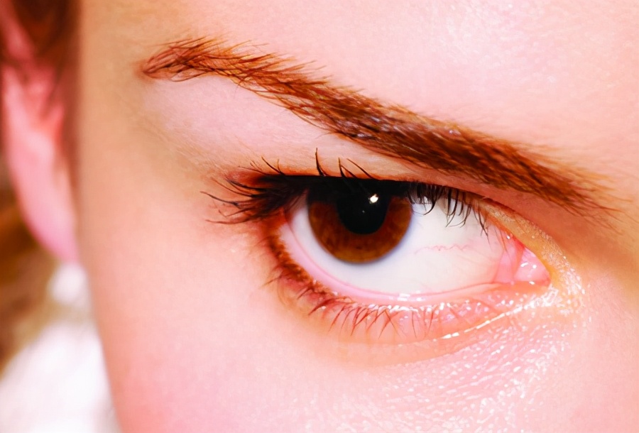 双眼皮做出了错误的选择,眼睛变成这样