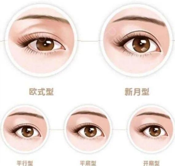<strong>双眼皮一看就很假?你是不是踩了这些坑</strong>