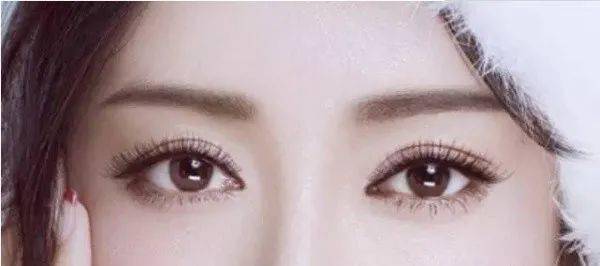 <strong>双眼皮做出了错误的选择,眼睛变成这样</strong>