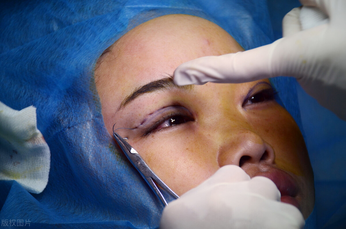 <strong>怎么样双眼皮才算失败你清楚吗?</strong>