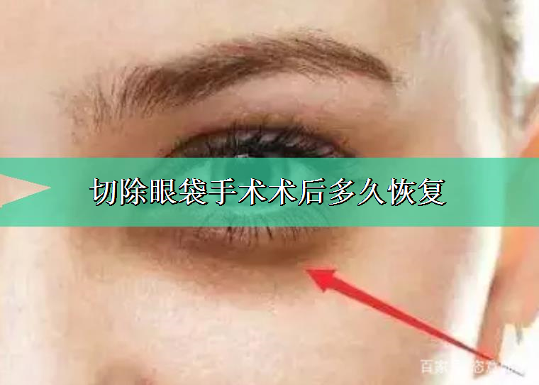 大神来谈谈切除眼袋手术术后多久恢复 大神来谈谈切除眼袋手术术后多久恢复