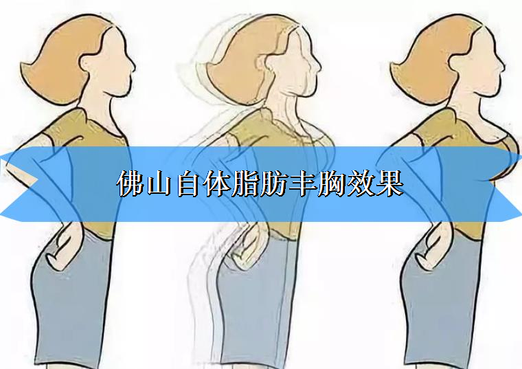 桃子姐给你说说佛山自体脂肪丰胸效果 桃子姐给你说说佛山自体脂肪丰胸效果