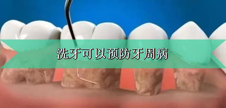 爱美人士谈谈洗牙可以预防牙周病 爱美人士谈谈洗牙可以预防牙周病