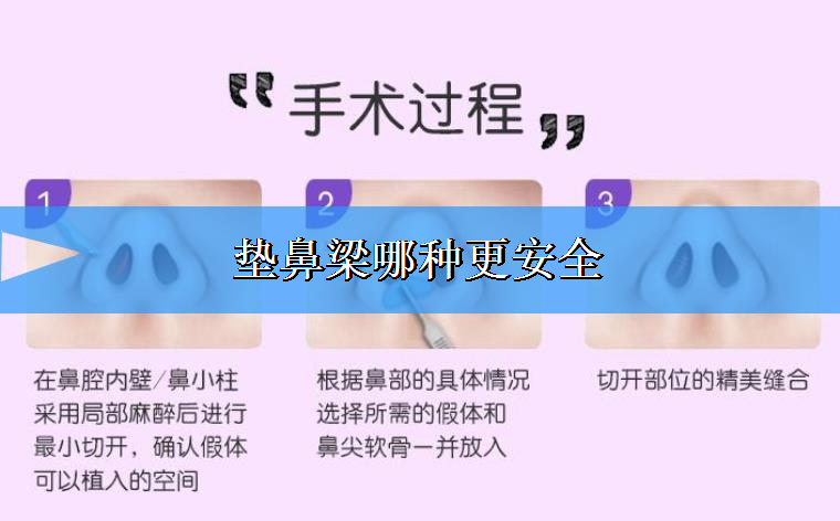 关于解答垫鼻梁哪种更安全? 关于解答垫鼻梁哪种更安全?
