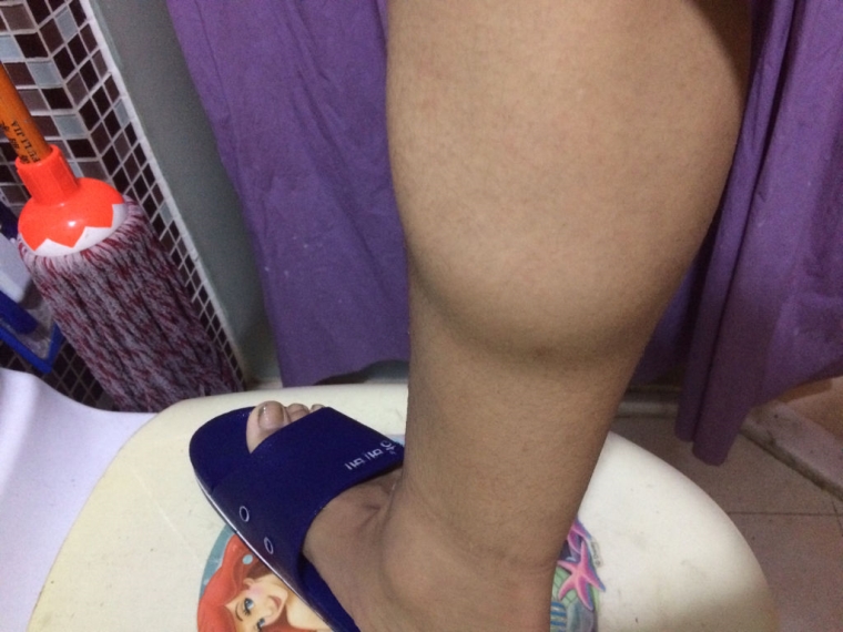 爱美人士谈谈腿部粗有什么方法解决 爱美人士谈谈腿部粗有什么方法解决