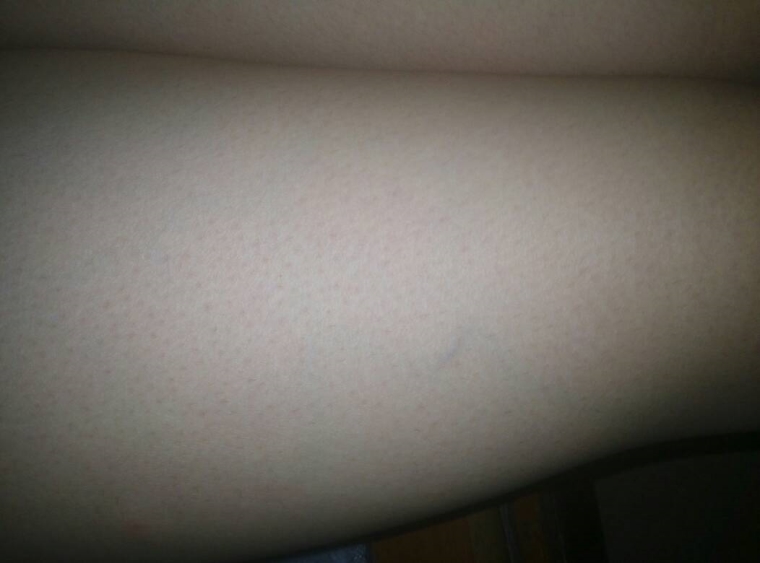 爱美人士谈谈腿部粗有什么方法解决 爱美人士谈谈腿部粗有什么方法解决