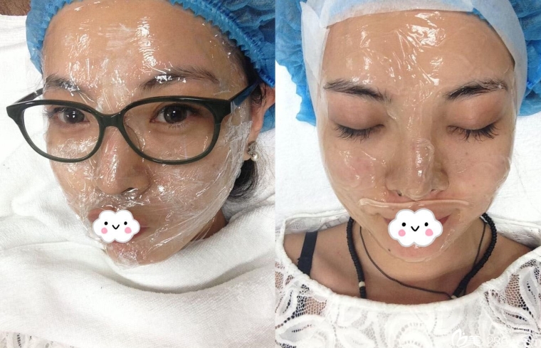 专家亲自说说全身激光美白多少钱 专家亲自说说全身激光美白多少钱