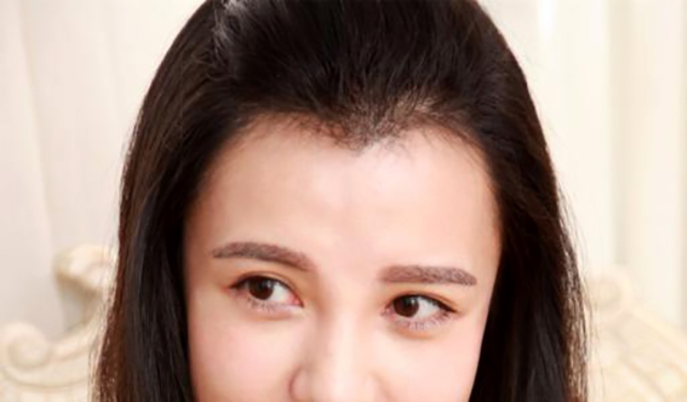 解答一下广州美人尖种植效果好吗