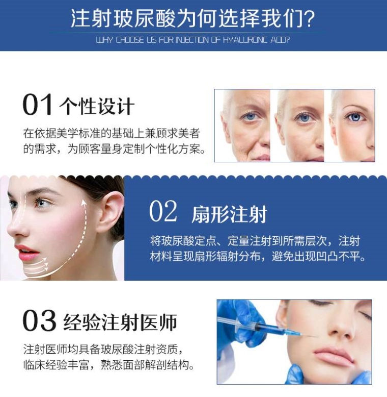 关于聊聊玻尿酸填充丰太阳穴大约多少钱