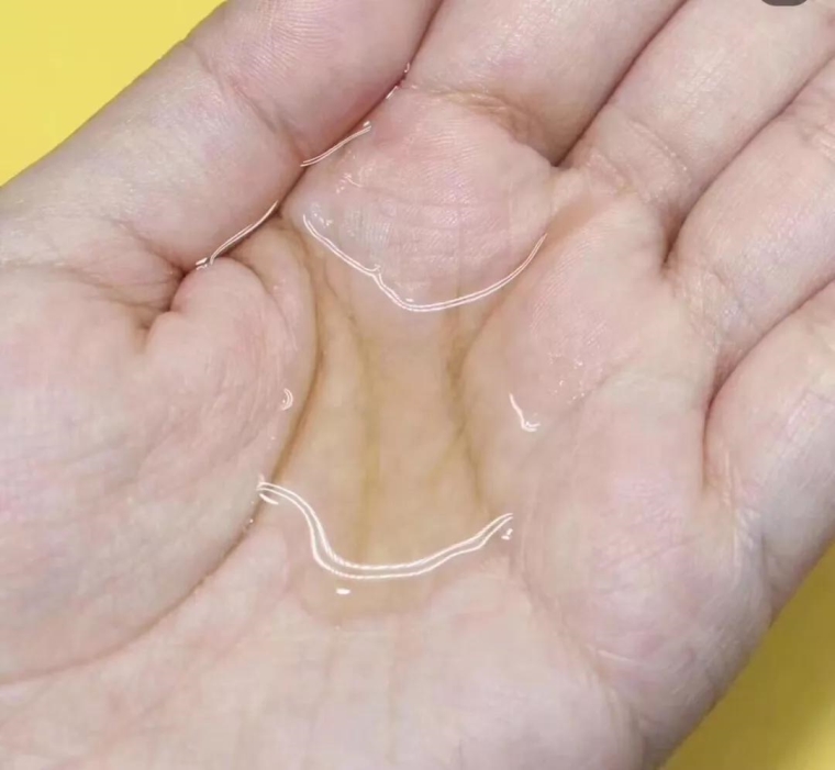 编辑告诉你常州激光脱毛效果怎么样 编辑告诉你常州激光脱毛效果怎么样