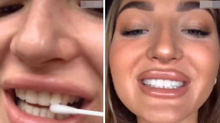 爱美人士聊石家庄牙齿美白多少钱 爱美人士聊石家庄牙齿美白多少钱