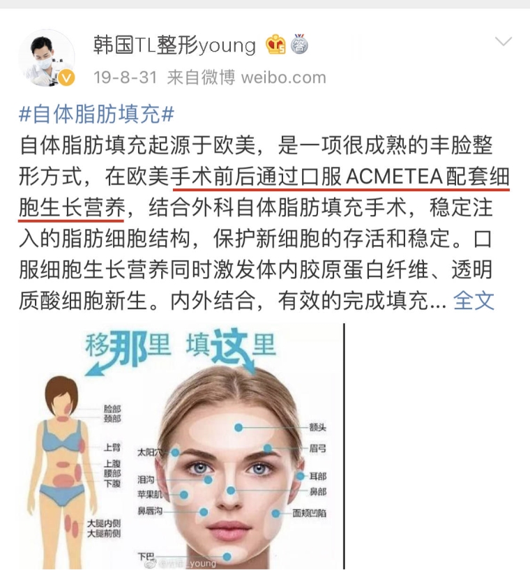 经验人士给你说苏州自体脂肪填充面部安全吗 经验人士给你说苏州自体脂肪填充面部安全吗