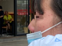 小编今天说说重庆肋骨隆鼻多少钱