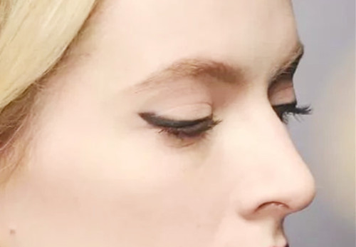 鼻子硅胶取出的危害有哪些?危害大吗? 鼻子硅胶取出的危害有哪些?危害大吗?