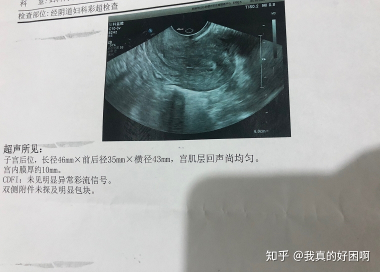 爱美人士聊广州假体垫下巴一个月还没恢复正常吗 爱美人士聊广州假体垫下巴一个月还没恢复正常吗