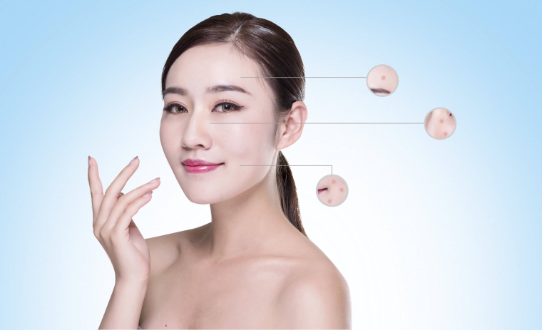 桃子姐聊聊为什么会长痘痘,有哪些危害 桃子姐聊聊为什么会长痘痘,有哪些危害