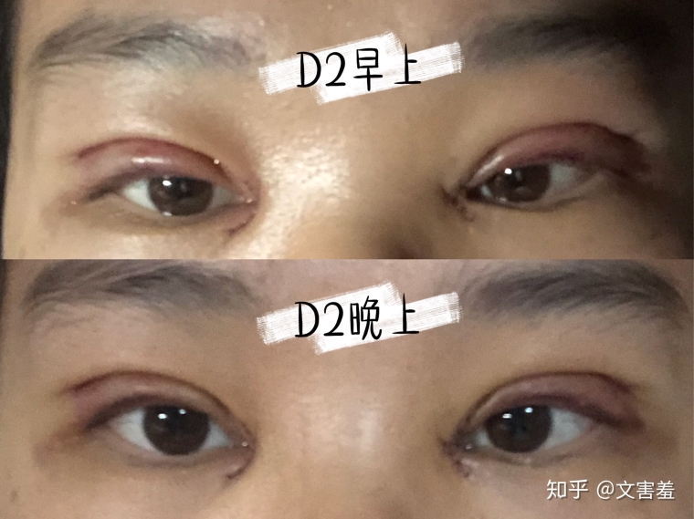 主编告诉你苏州哪里做韩式纹眉比较好 主编告诉你苏州哪里做韩式纹眉比较好