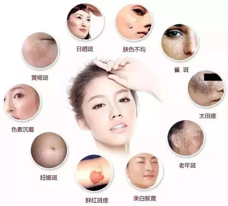 主编告诉你苏州皮秒激光祛斑几次见效 主编告诉你苏州皮秒激光祛斑几次见效