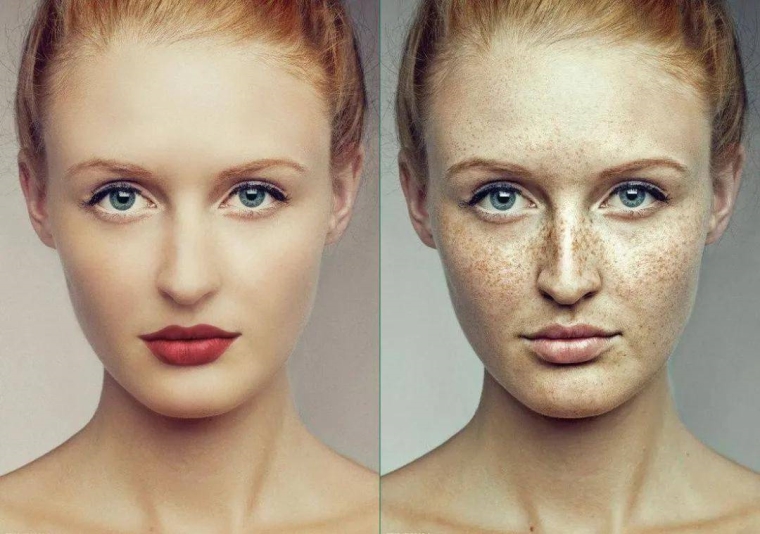 主编告诉你苏州皮秒激光祛斑几次见效 主编告诉你苏州皮秒激光祛斑几次见效