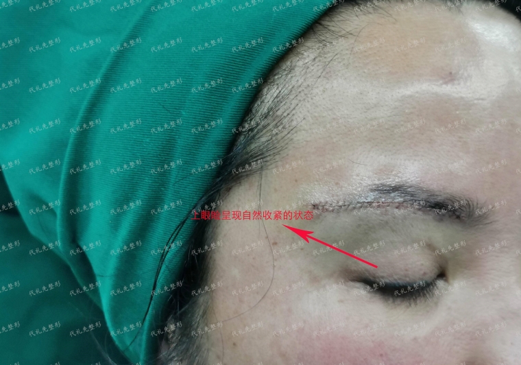 大师今天说下激光祛疤手术多少钱 大师今天说下激光祛疤手术多少钱