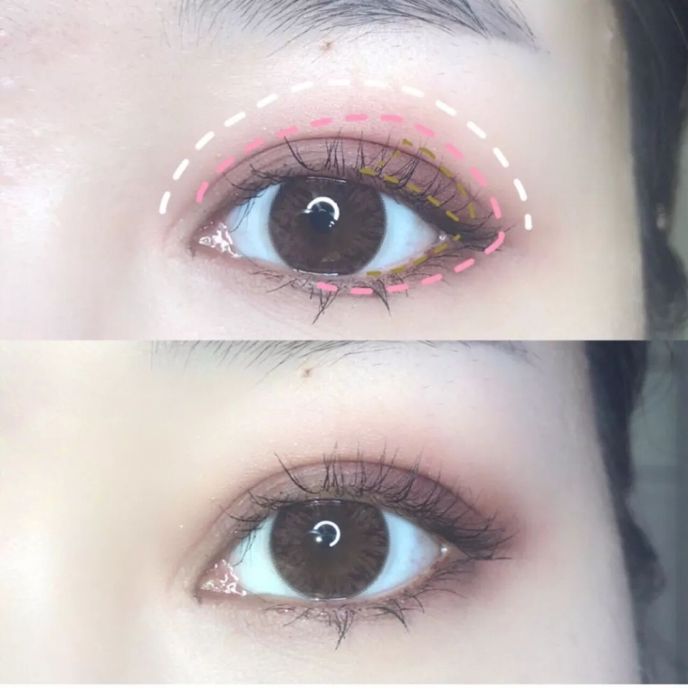 编辑告诉你割双眼皮要花多少钱 编辑告诉你割双眼皮要花多少钱