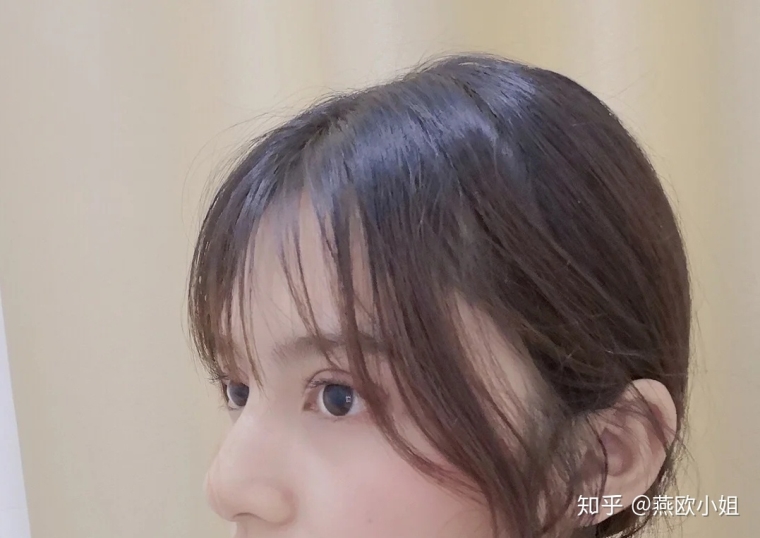 编辑告诉你割双眼皮要花多少钱 编辑告诉你割双眼皮要花多少钱