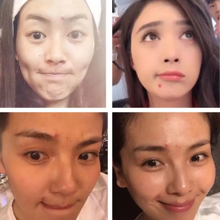 谈一谈广州激光脱手臂汗毛效果怎么样 谈一谈广州激光脱手臂汗毛效果怎么样