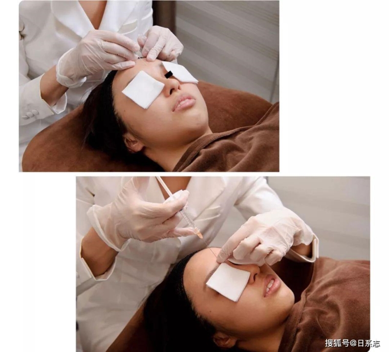 图文解说广州假体隆胸用硅胶还是膨体好 图文解说广州假体隆胸用硅胶还是膨体好