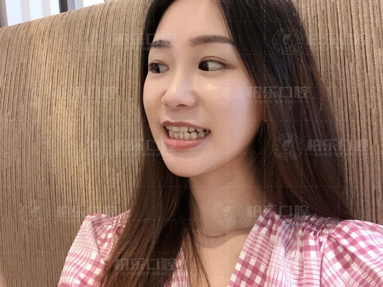 编辑来谈谈矫正牙齿有年龄限制吗 编辑来谈谈矫正牙齿有年龄限制吗