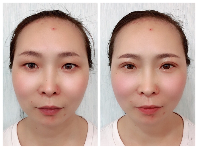 今日解答西安丰胸要多少钱 今日解答西安丰胸要多少钱