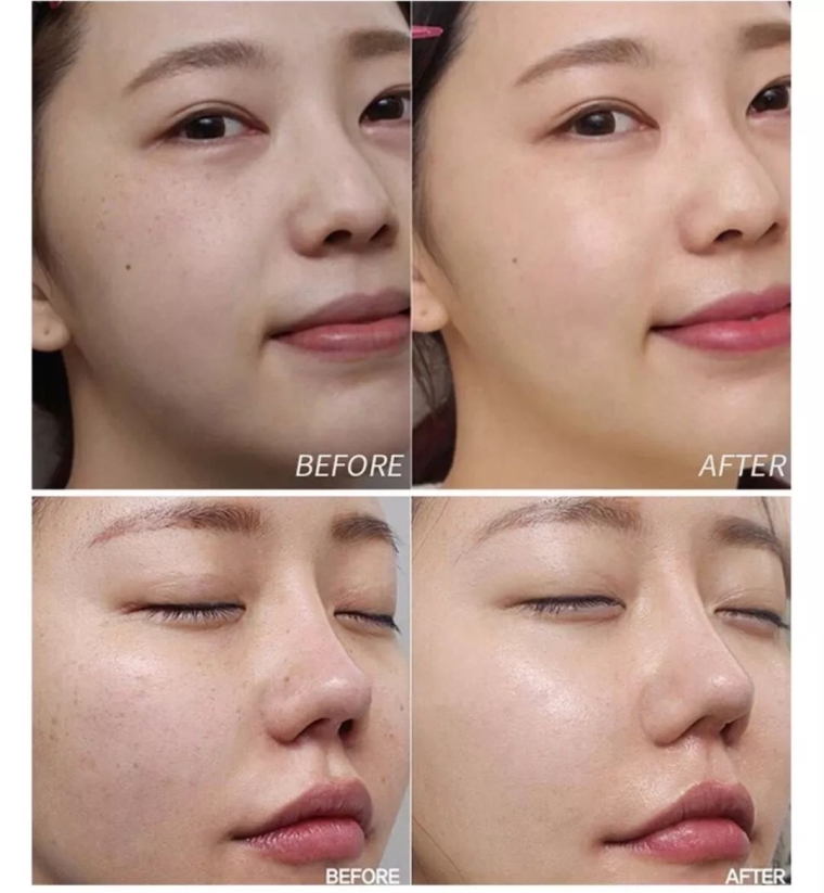 小编今天说说北京老年人能做激光祛斑吗 小编今天说说北京老年人能做激光祛斑吗