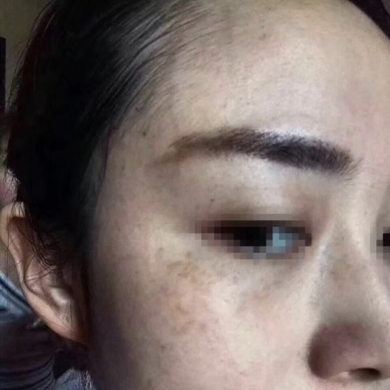 小编今天说说北京老年人能做激光祛斑吗 小编今天说说北京老年人能做激光祛斑吗