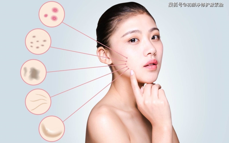 解答一下万州面部脱毛后要注意哪些方面 解答一下万州面部脱毛后要注意哪些方面