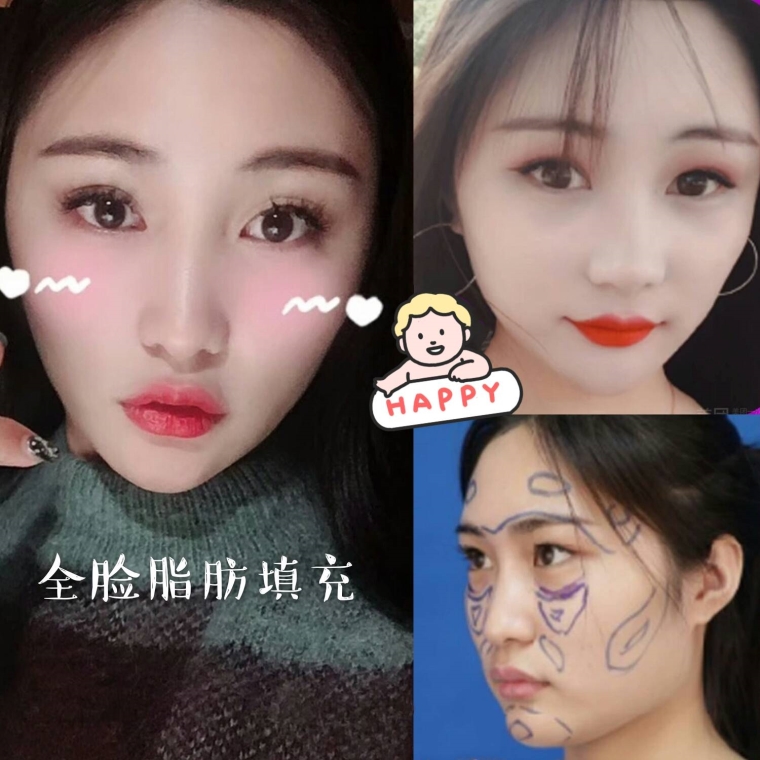 解答一下万州面部脱毛后要注意哪些方面 解答一下万州面部脱毛后要注意哪些方面