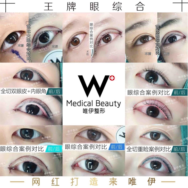 专家亲自说说自体脂肪丰胸效果好不好 专家亲自说说自体脂肪丰胸效果好不好