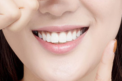 洗牙需要注意什么 洗牙需要注意什么