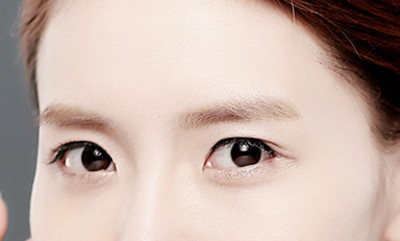 自体脂肪填充太阳穴贵吗 自体脂肪填充太阳穴贵吗