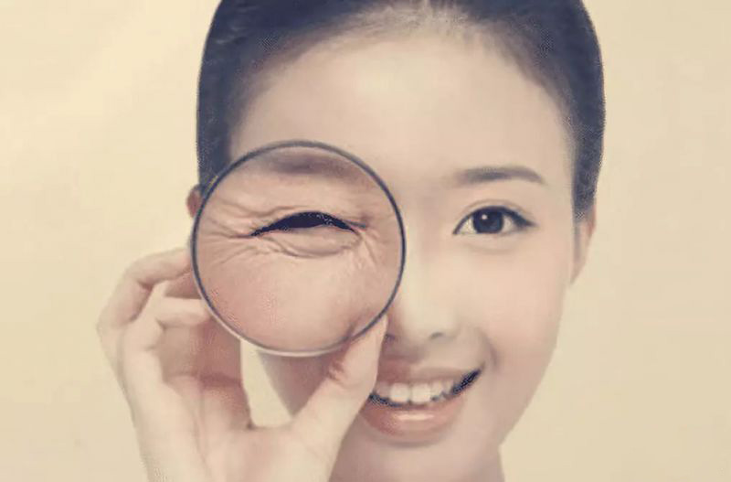 去鱼尾纹 去鱼尾纹