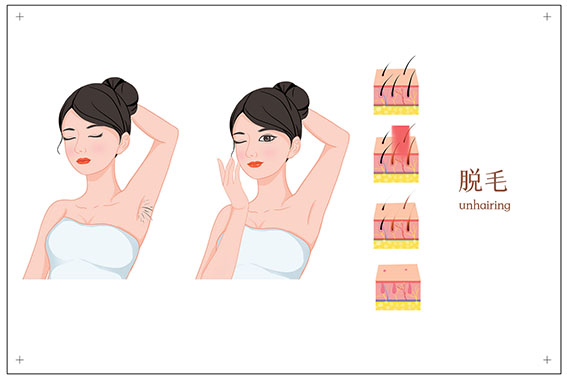 1657854273402275.jpg 摄图网_401804030_banner_女性激光脱毛术医美插图(非企业商用).jpg