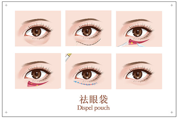 1658109003179557.jpg 摄图网_401790814_banner_祛眼袋手术医美插画(非企业商用).jpg