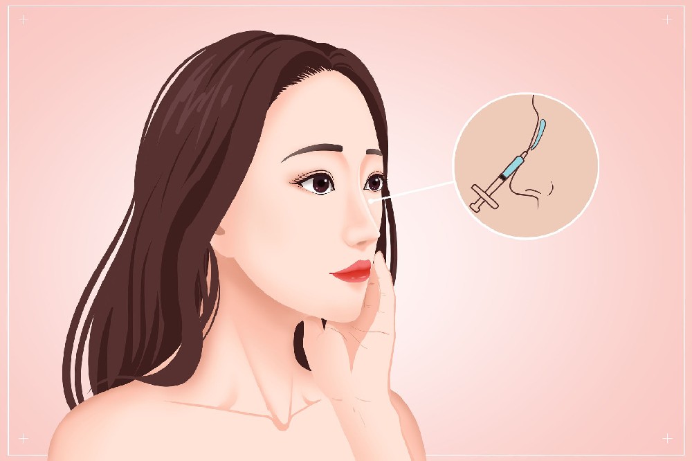 1658193970170272.jpg 摄图网_401808887_医美注射隆鼻医疗插画(非企业商用).jpg