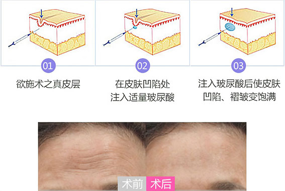 1658283472136198.jpg R-C.jpg